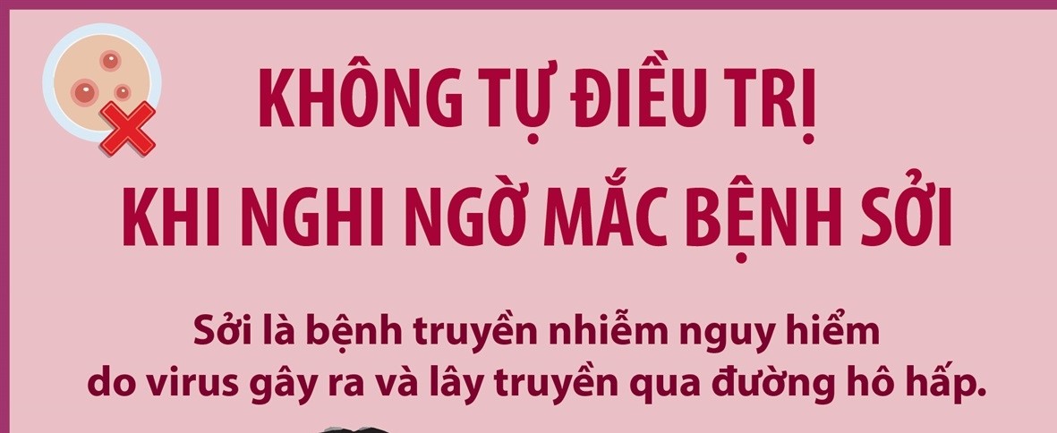 Không tự điều trị khi nghi ngờ mắc bệnh sởi
