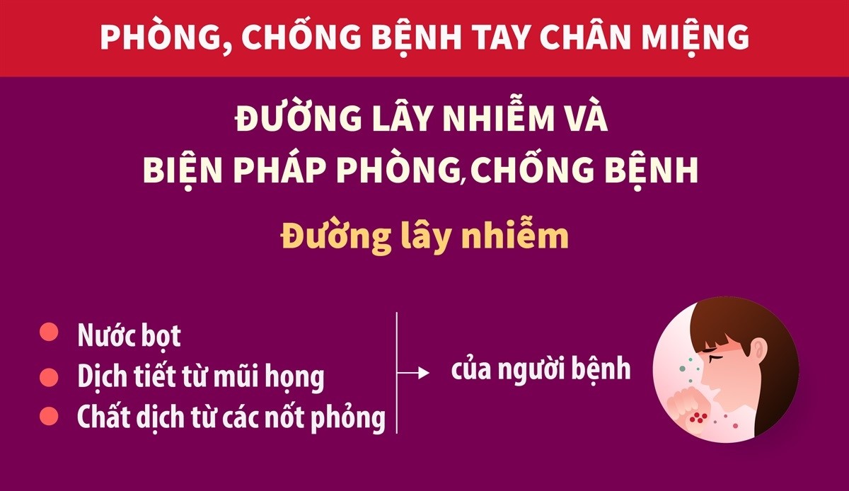 Bệnh tay chân miệng: Đường lây nhiễm và biện pháp phòng, chống