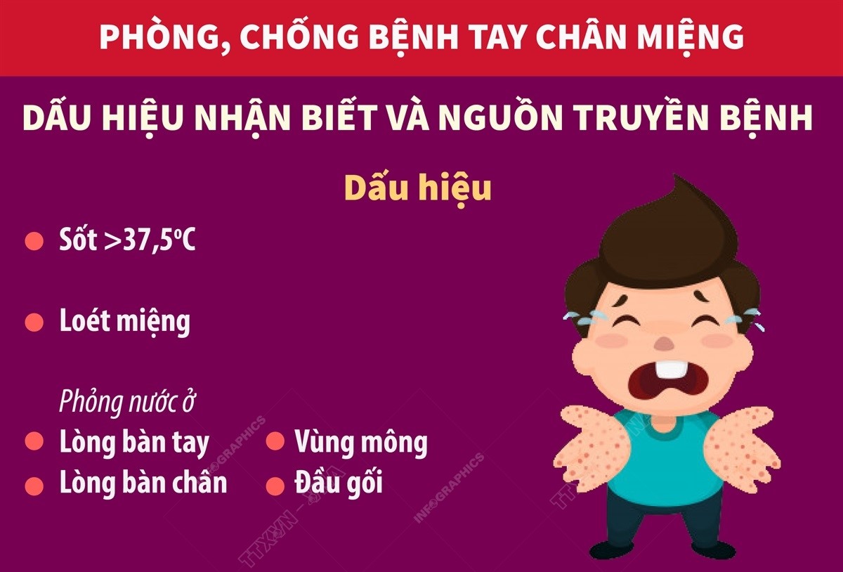 Bệnh tay chân miệng: Dấu hiệu nhận biết và nguồn truyền bệnh